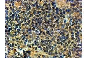 ABIN570911 (2µg/ml) staining of paraffin embedded Human Tonsil. (PRDM1 antibody  (C-Term))