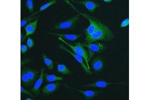 IF analysis of Cytokeratin 18 using anti-Cytokeratin 18 antibody (ABIN7600573). (Cytokeratin 18 antibody  (AA 204-430))