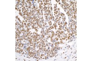 Immunohistochemistry (IHC) image for anti-Heterogeneous Nuclear Ribonucleoprotein K (HNRNPK) (C-Term) antibody (ABIN7454660) (HNRNPK antibody  (C-Term))