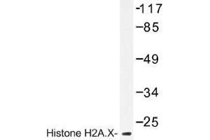 Image no. 1 for anti-H2A Histone Family, Member X (H2AFX) antibody (ABIN317781) (H2AFX antibody)