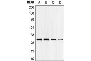 Western blot analysis of GPR18 expression in HEK293T (A), Jurkat (B), mouse brain (C), rat brain (D) whole cell lysates. (GPR18 antibody  (Center))