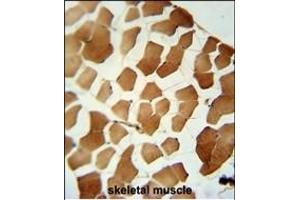 P6C Antibody (C-term) (ABIN6242920 and ABIN6579047) immunohistochemistry analysis in formalin fixed and paraffin embedded human skeletal muscle followed by peroxidase conjugation of the secondary antibody and DAB staining. (PPP6C antibody  (C-Term))