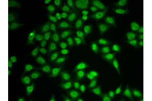 Immunofluorescence analysis of MCF-7 cells using PSMB9 antibody. (PSMB9 antibody)