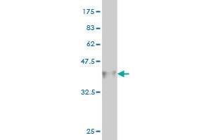 Western Blot detection against Immunogen (34. (HOXD11 antibody  (AA 1-76))