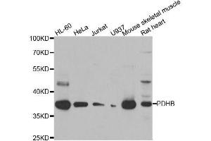Western blot analysis of extracts of various cell lines, using PDHB antibody. (PDHB antibody  (AA 1-300))