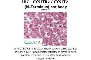 Image no. 1 for anti-Cysteinyl Leukotriene Receptor 2 (CYSLTR2) (N-Term) antibody (ABIN1733466) (CasLTR2 antibody  (N-Term))