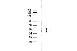 anti-NDRG Family Member 4 (NDRG4) (Internal Region) antibody