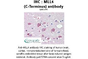 Image no. 1 for anti-Histone-Lysine N-Methyltransferase MLL4 (MLL4) (C-Term) antibody (ABIN1736980)