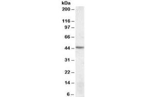 Western blot testing of MOLT4 lysate with DRAK2 antibody at 1ug/ml. (DRAK2 antibody)
