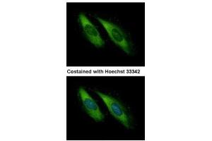 ICC/IF Image Immunofluorescence analysis of methanol-fixed HeLa, using Munc 13-4, antibody at 1:500 dilution. (UNC13D antibody  (C-Term))