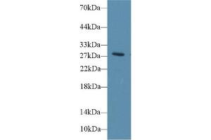 Western Blot; Sample: Rat Blood Cells lysate; Primary Ab: 1µg/ml Rabbit Anti-Rat DIO3 Antibody Second Ab: 0.