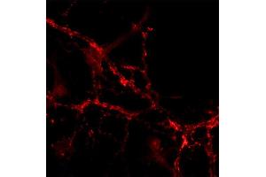 Immunocytochemistry on cultured hippocampus neurons (dilution 1 : 200). (Slc30a3 antibody  (AA 2-75))