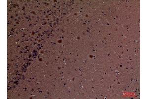 Immunohistochemistry (IHC) image for anti-Peptidylprolyl Isomerase A (Cyclophilin A) (PPIA) (Internal Region) antibody (ABIN6284334)