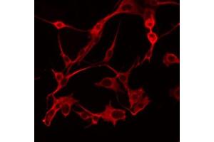 ABIN6274791 staining COLO205 by IF/ICC. (ABHD6 antibody  (Internal Region))