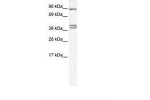 Image no. 1 for anti-Chloride Channel Kb (CLCNKB) (C-Term) antibody (ABIN6735456) (CLCNKB antibody  (C-Term))