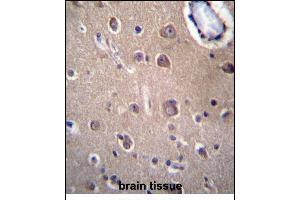 Immunohistochemistry (Paraffin-embedded Sections) (IHC (p)) image for anti-Solute Carrier Family 8 (Sodium/calcium Exchanger), Member 3 (SLC8A3) (AA 585-614) antibody (ABIN656735)