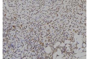 ABIN6278967 at 1/100 staining Human spleen tissue by IHC-P.