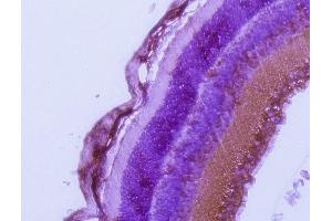 Immunohistochemistry (IHC) image for anti-RAB27A, Member RAS Oncogene Family (RAB27A) (C-Term) antibody (ABIN1440000) (RAB27A antibody  (C-Term))
