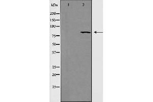 Western blot analysis of extracts from HeLa cells using RAD54 antibody. (RAD54L antibody  (C-Term))