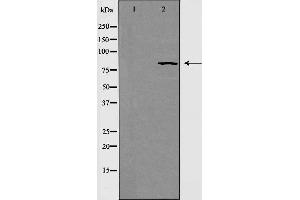 Western blot analysis of extracts from HeLa cells using RAD54 antibody.