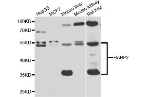 Western blot analysis of extracts of various cell lines, using HABP2 antibody. (HABP2 antibody)