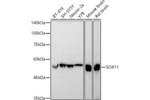 Western blot analysis of extracts of various cell lines, using SOX11 antibody (ABIN7270569) at 1:1000 dilution.