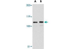 Western blot analysis of LRFN3 in K-562 cell lysate with LRFN3 polyclonal antibody  at (A) 1 and (B) 2 ug/mL .