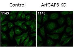 Immunofluorescence Microscopy of Rabbit Anti-ArfGAP3 Antibody. (ARFGAP3 antibody)