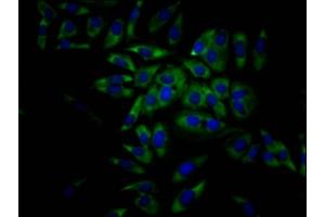 Immunofluorescence staining of Hela Cells with ABIN7127468 at 1:50, counter-stained with DAPI. (Recombinant EIF4A1 antibody)