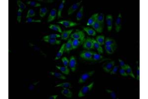 Immunofluorescence staining of Hela Cells with ABIN7127468 at 1:50, counter-stained with DAPI. (Recombinant EIF4A1 antibody)