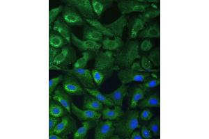 Immunofluorescence analysis of U-2 OS cells using EIF3G Polyclonal Antibody (ABIN1679693, ABIN3018723, ABIN3018724 and ABIN6220556) at dilution of 1:100 (40x lens). (EIF3G antibody  (AA 1-320))