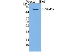 Detection of Recombinant COL4a3, Human using Polyclonal Antibody to Collagen Type IV Alpha 3 (COL4a3)