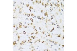 Immunohistochemistry of paraffin-embedded mouse brain using NRG4 antibody (ABIN3016309, ABIN3016310, ABIN3016311 and ABIN6219713) at dilution of 1:100 (40x lens). (Neuregulin 4 antibody  (AA 1-115))