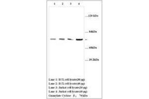 Image no. 1 for anti-Guanylate Cyclase 1, Soluble, beta 3 (GUCY1B3) (AA 188-207) antibody (ABIN791333) (GUCY1B3 antibody  (AA 188-207))