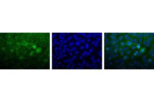 Image no. 2 for anti-Nudix (Nucleoside Diphosphate Linked Moiety X)-Type Motif 1 (NUDT1) (C-Term) antibody (ABIN363382) (NUDT1 antibody  (C-Term))