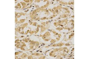Immunohistochemistry (IHC) image for anti-Small Ubiquitin Related Modifier Protein 1 (SUMO1) (AA 1-101) antibody (ABIN3022994)