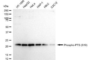 anti-6-Pyruvoyltetrahydropterin Synthase (PTS) (pSer19) antibody