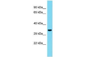 Host: Rabbit Target Name: CCDC75 Sample Type: Fetal Kidney lysates Antibody Dilution: 1. (CCDC75 antibody  (N-Term))