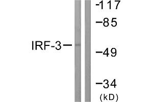 Immunohistochemistry analysis of paraffin-embedded human lung carcinoma tissue using IRF-3 (Ab-385) antibody. (IRF3 antibody  (Ser385))