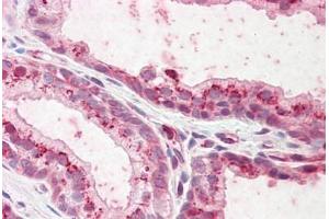 Human Prostate: Formalin-Fixed, Paraffin-Embedded (FFPE) (Plakophilin 2 antibody  (AA 125-139))