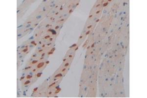IHC-P analysis of Mouse Heart Tissue, with DAB staining. (PD-L1 antibody  (AA 48-290))