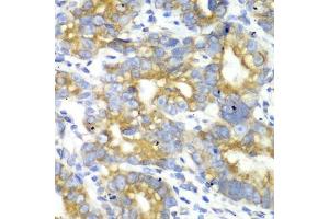 Immunohistochemistry (Paraffin-embedded Sections) (IHC (p)) image for anti-Transcription Factor A, Mitochondrial (TFAM) (AA 1-220) antibody (ABIN6149024)