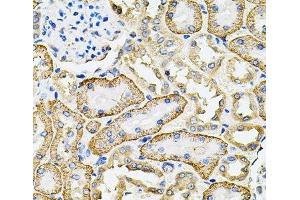 Immunohistochemistry of paraffin-embedded Rat kidney using SLC4A4 / NBC Polyclonal Antibody at dilution of 1:100 (40x lens).