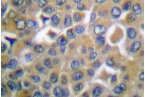 Image no. 2 for anti-Protein tyrosine Phosphatase, Non-Receptor Type 13 (APO-1/CD95 (Fas)-Associated Phosphatase) (PTPN13) antibody (ABIN265414) (PTPN13 antibody)