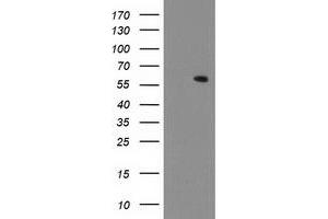 HEK293T cells were transfected with the pCMV6-ENTRY control (Left lane) or pCMV6-ENTRY MKRN1 (Right lane) cDNA for 48 hrs and lysed. (MKRN1 antibody)