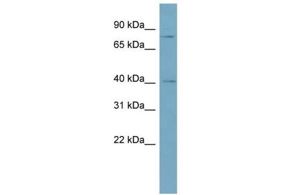 SPPL2C antibody  (Middle Region)