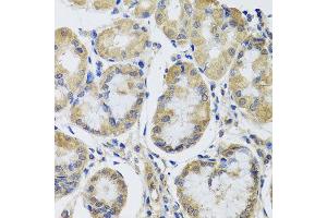 Immunohistochemistry of paraffin-embedded human gastric using MRPL1 antibody at dilution of 1:100 (x40 lens). (MRPL1 antibody)