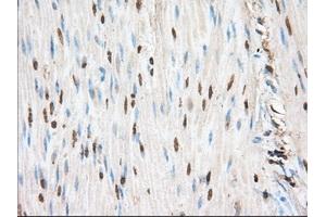 Immunohistochemical staining of paraffin-embedded Human liver tissue using anti-PIM2 mouse monoclonal antibody. (PIM2 antibody)