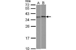 WB Image Sample (30 ug of whole cell lysate) A: HeLa B: HCT116 12% SDS PAGE antibody diluted at 1:1000 (WBSCR22 antibody  (Center))