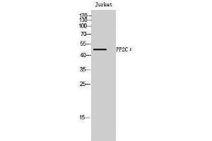Western Blotting (WB) image for anti-Protein Phosphatase, Mg2+/Mn2+ Dependent, 1L (PPM1L) (Internal Region) antibody (ABIN3176986) (PPM1L antibody  (Internal Region))